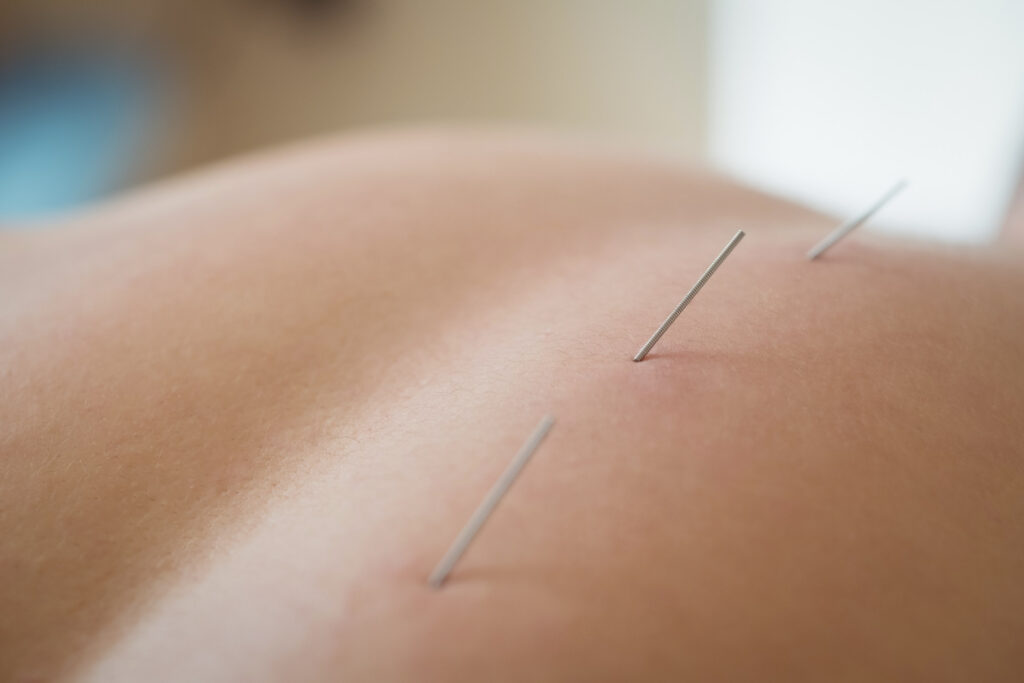 Reiki Therapy